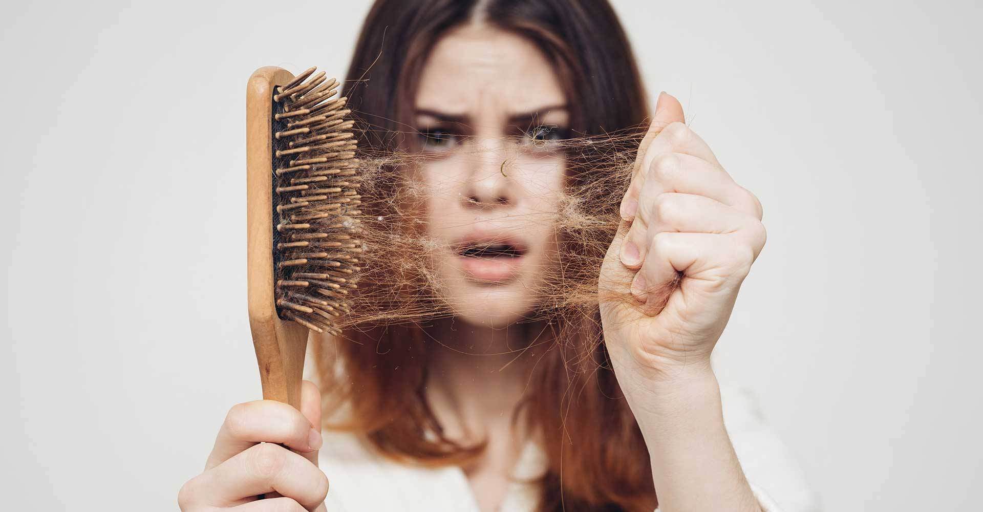 foto de Alopecia / queda de cabelo